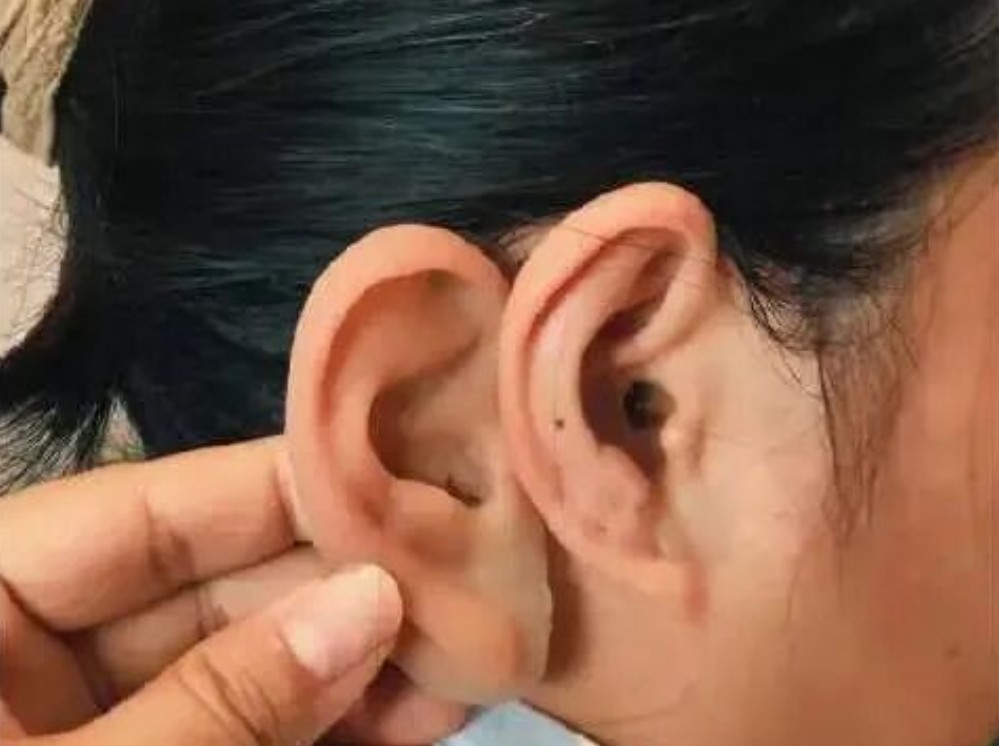 高仿真硅胶义耳（成人常规款）